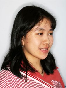 Before Jaw Repositioning (Orthognathic) Surgery Before Jaw Repositioning (Orthognathic) Surgery