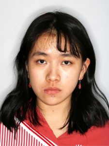 Before Jaw Repositioning (Orthognathic) Surgery Before Jaw Repositioning (Orthognathic) Surgery