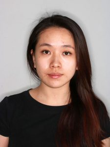 After Jaw Repositioning (Orthognathic) Surgery After Jaw Repositioning (Orthognathic) Surgery